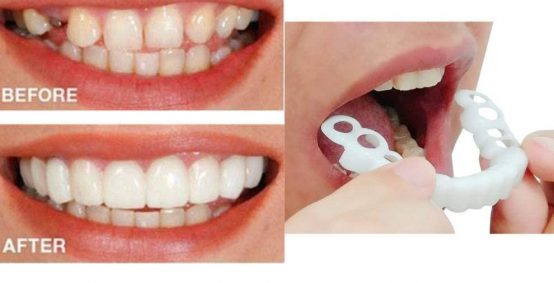 Snap on Smile Appointment